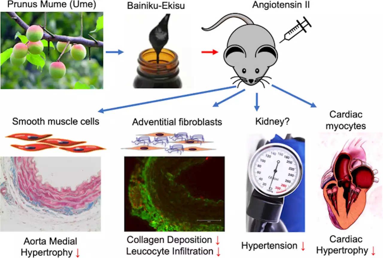 Infused juice concentrate of Japanese plum Prunus mume attenuates inflammatory vascular remodeling in a mouse model of hypertension induced by angiotensin II - Hypertension Research