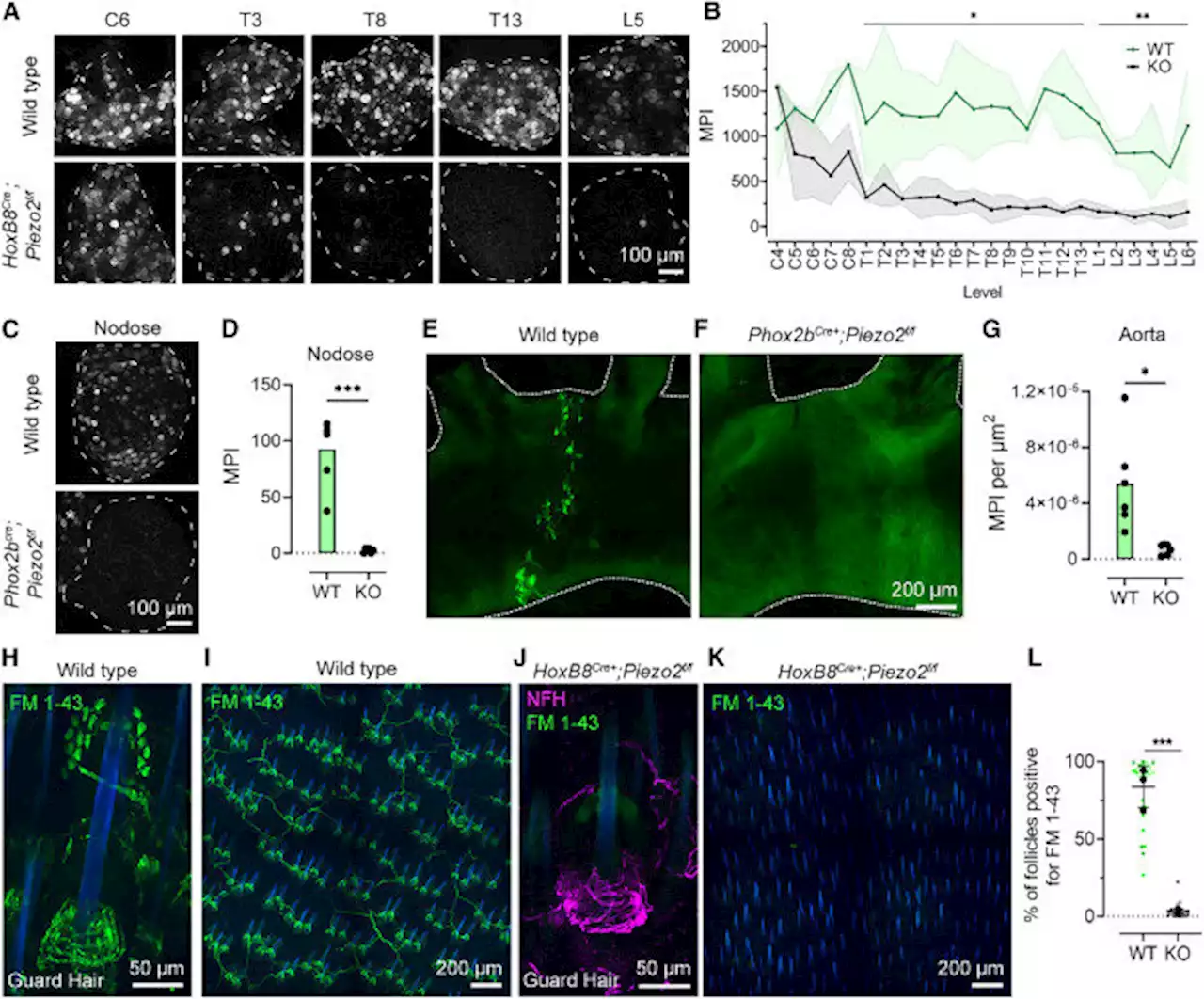 Researchers describe a new way to visualize force-sensing neurons