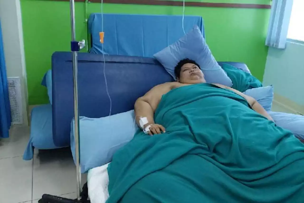 Dokter RSCM Ungkap Penyebab Fajri Alami Obesitas hingga 300 Kg