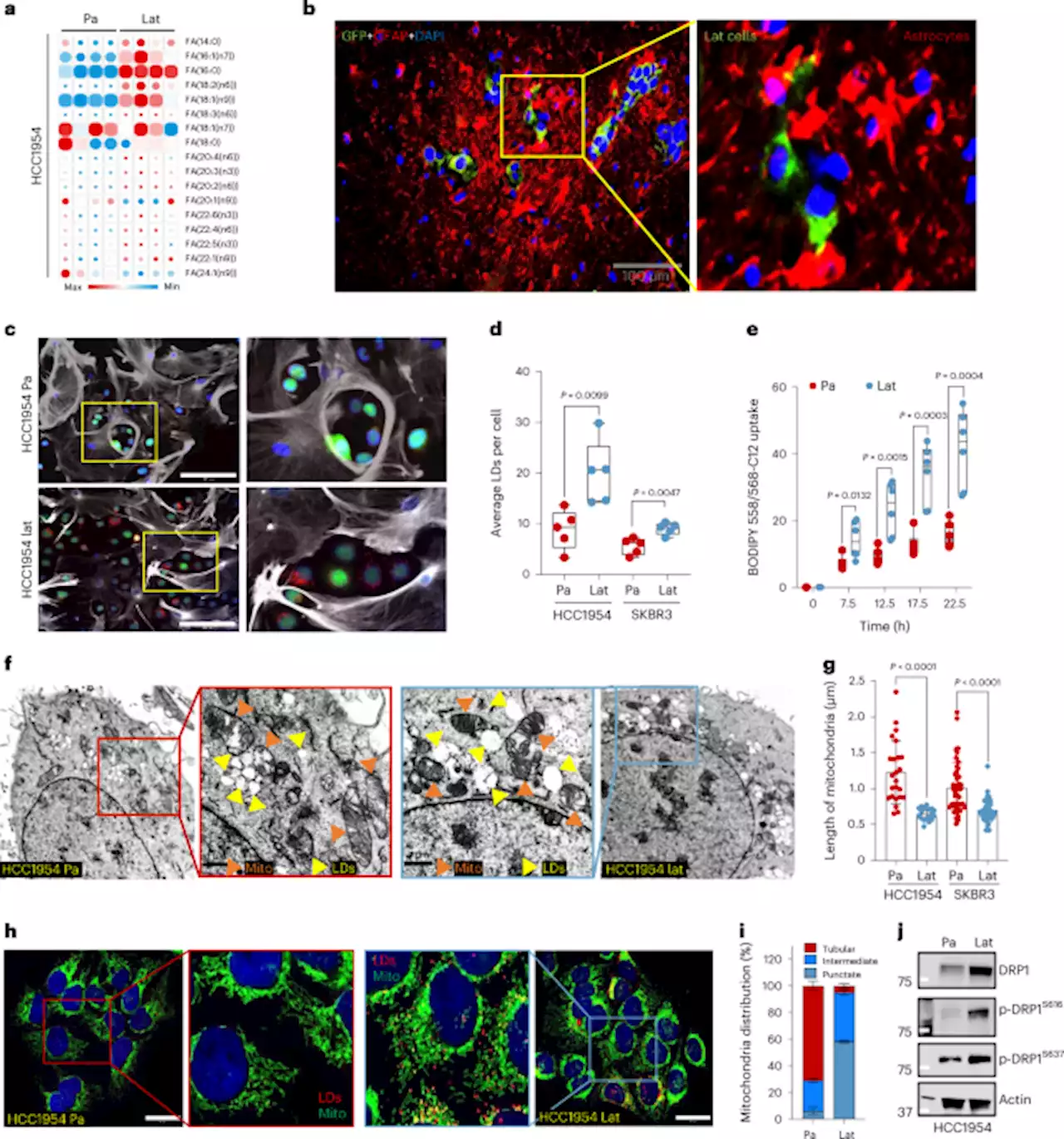 Limiting mitochondrial plasticity by targeting DRP1 induces metabolic reprogramming and reduces breast cancer brain metastases - Nature Cancer