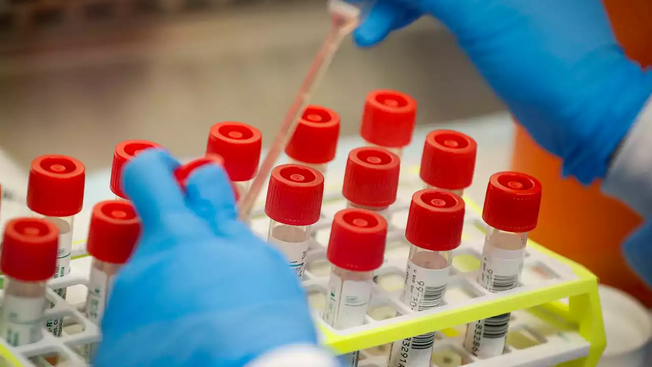 Confidence in science fell in 2022 while political divides persisted, poll shows