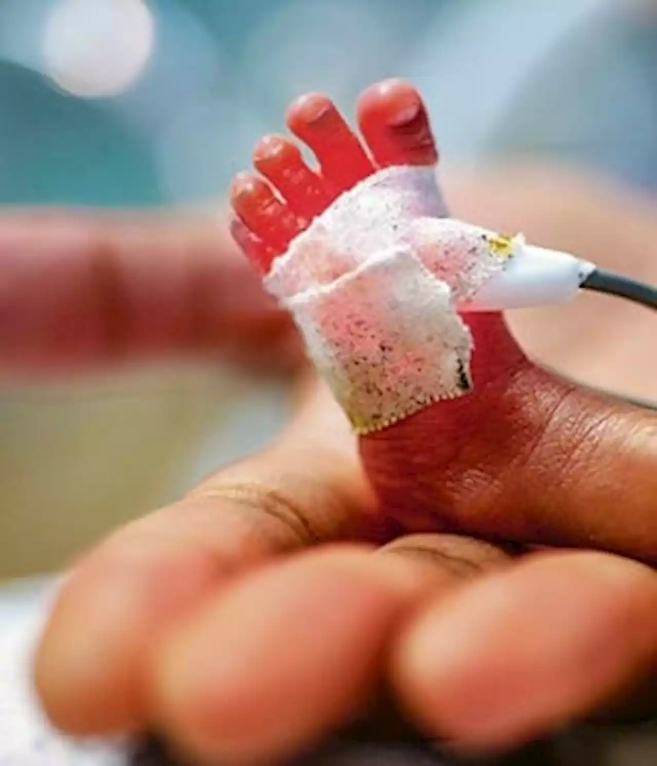 909 avoidable baby deaths at Baragwanath: blame health department, not staff | City Press