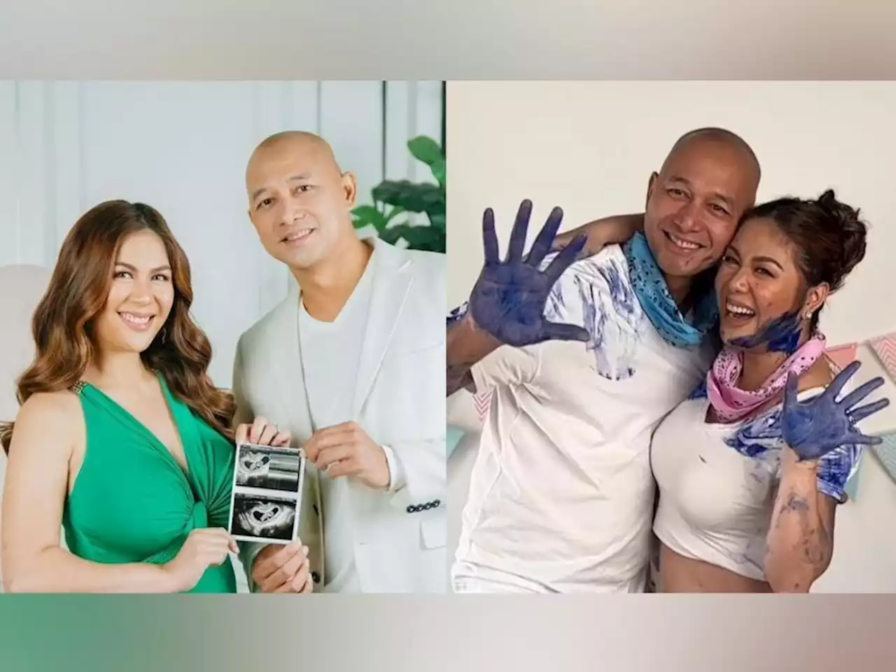 Valerie Concepcion and Francis Sunga are expecting a baby boy