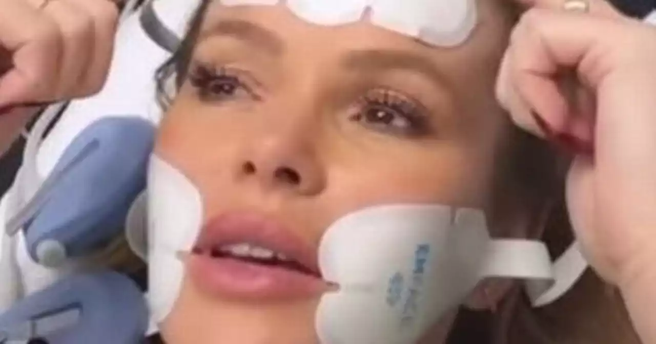 Amanda Holden shows off facelift as she says she'll look like a '12-year-old'