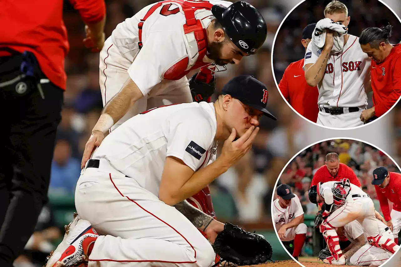 Red Sox’s Tanner Houck brought to hospital, received stitches after taking liner to face