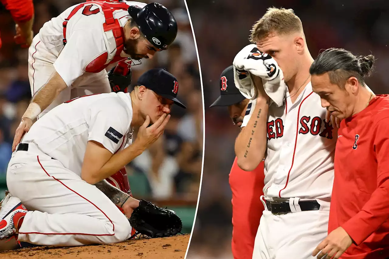 Red Sox starter Tanner Houck takes Kyle Higashioka line drive to face in scary scene