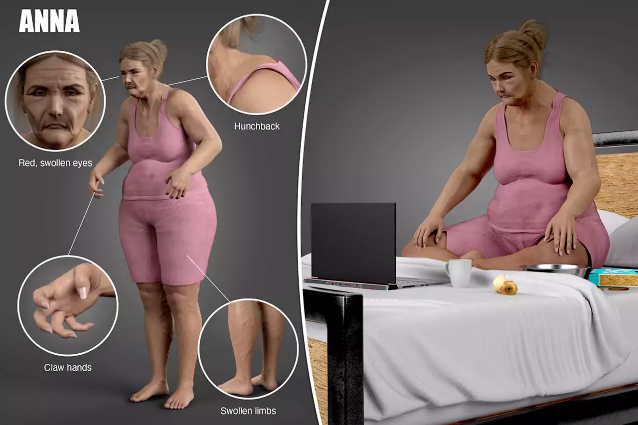 Shocking 3D model reveals what ‘damaging’ remote work could do to our bodies