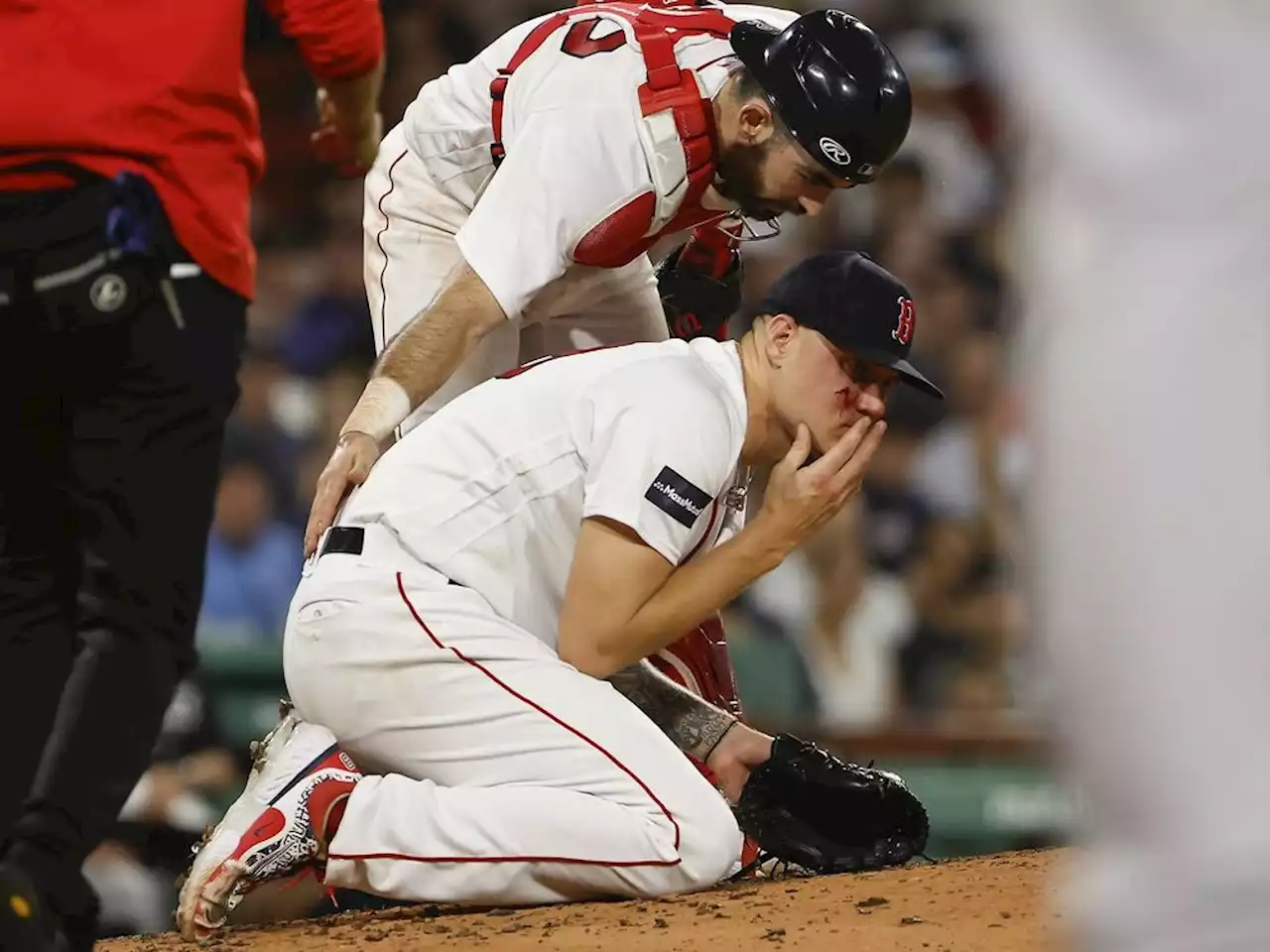 Red Sox unsure if pitcher Tanner Houck needs surgery after line drive to the face