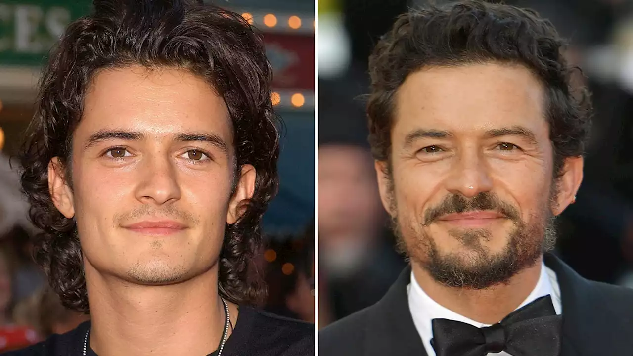 Orlando Bloom -- Good Genes Or Good Docs?!