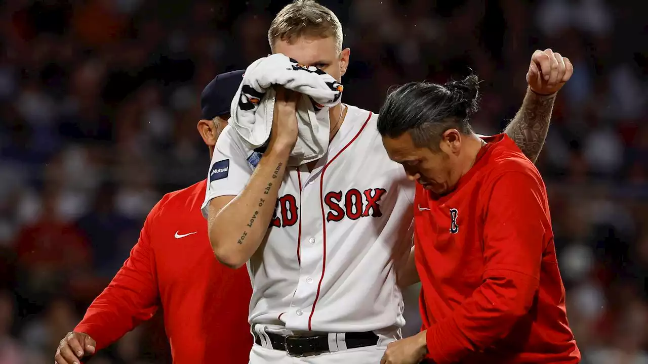 Red Sox P Tanner Houck suffers facial fracture, out indefinitely after line drive to face