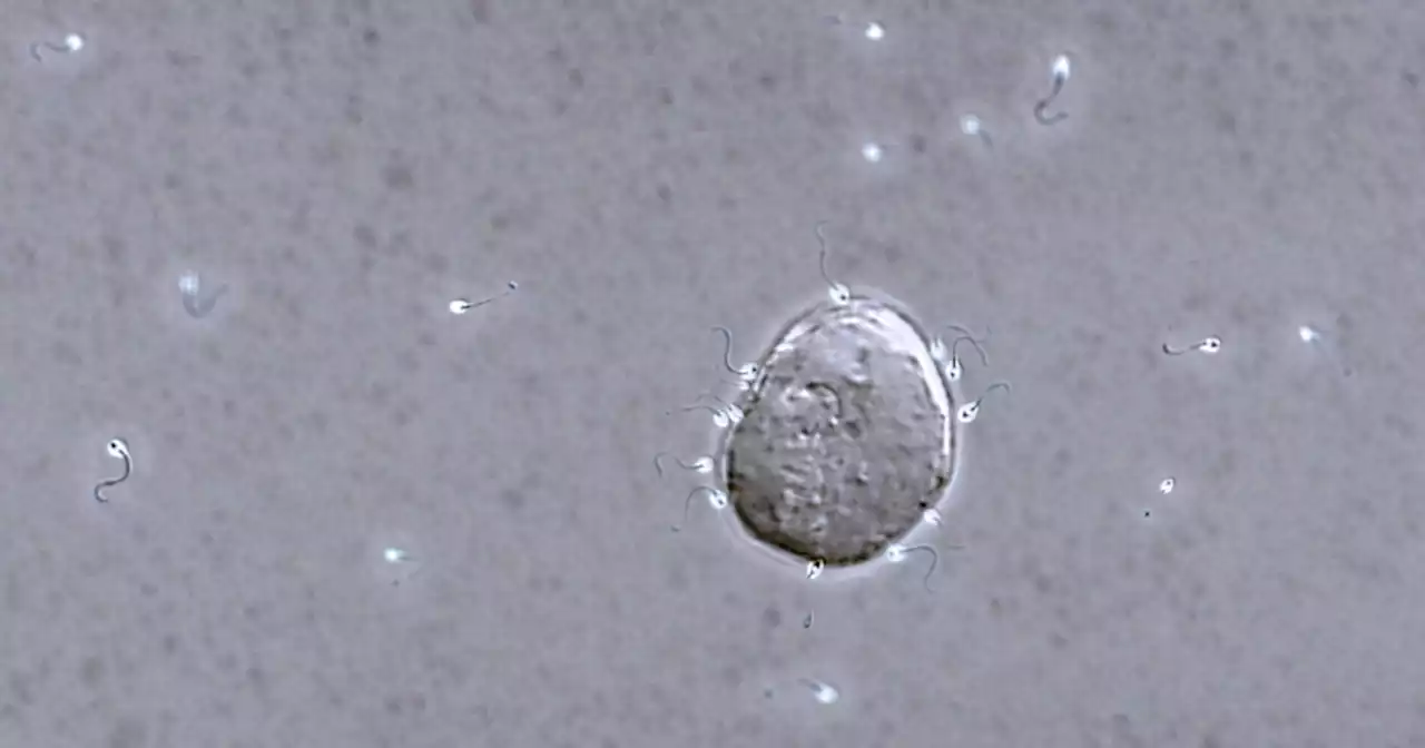 New fertility process called IVG could revolutionize reproduction