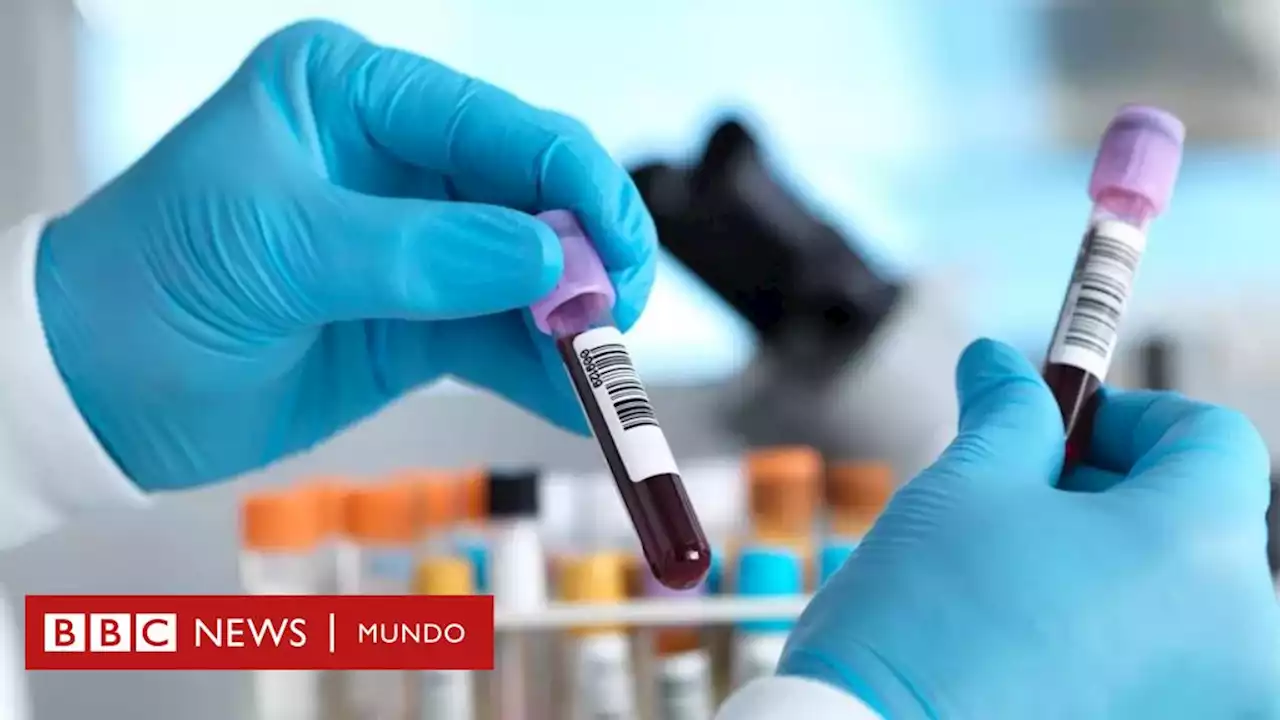 El prometedor examen de sangre para detectar cáncer que tiene entusiasmados a los científicos - BBC News Mundo