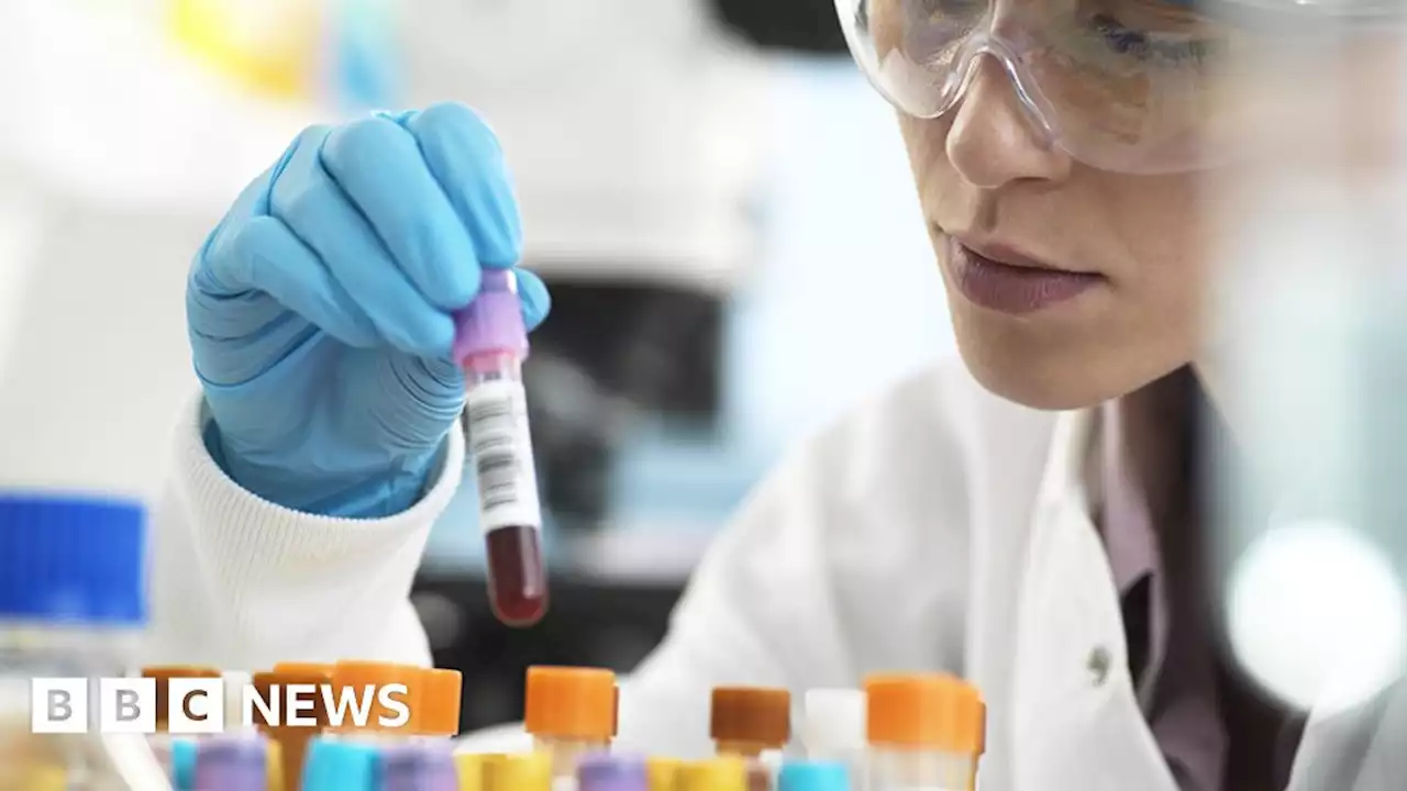 Multi-cancer blood test shows real promise in NHS study