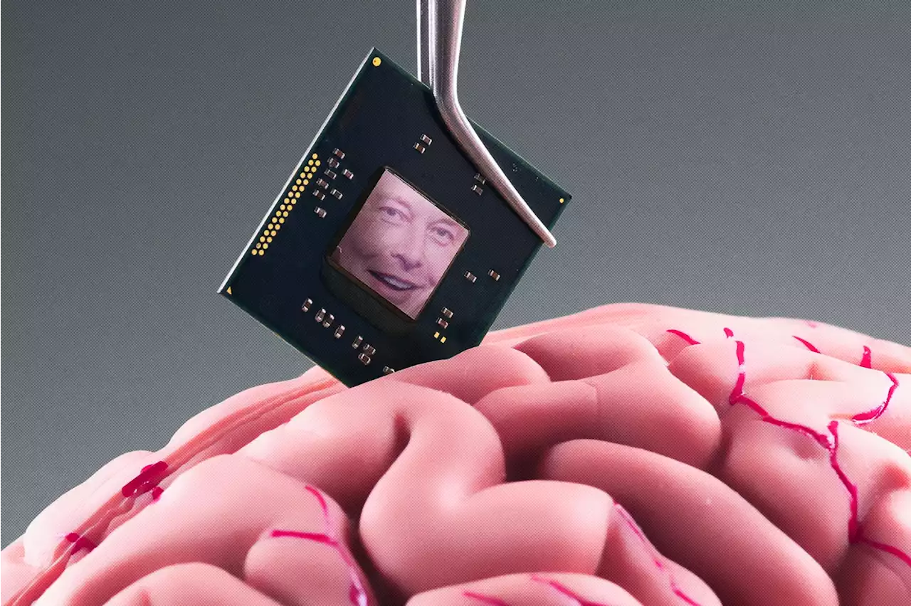 Meet the Folks Lining Up for Elon Musk's Brain Implant