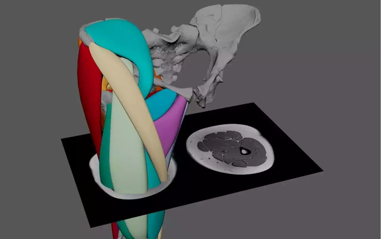 The 3-Million-Year-Old Lucy Was Built Like a Powerlifter