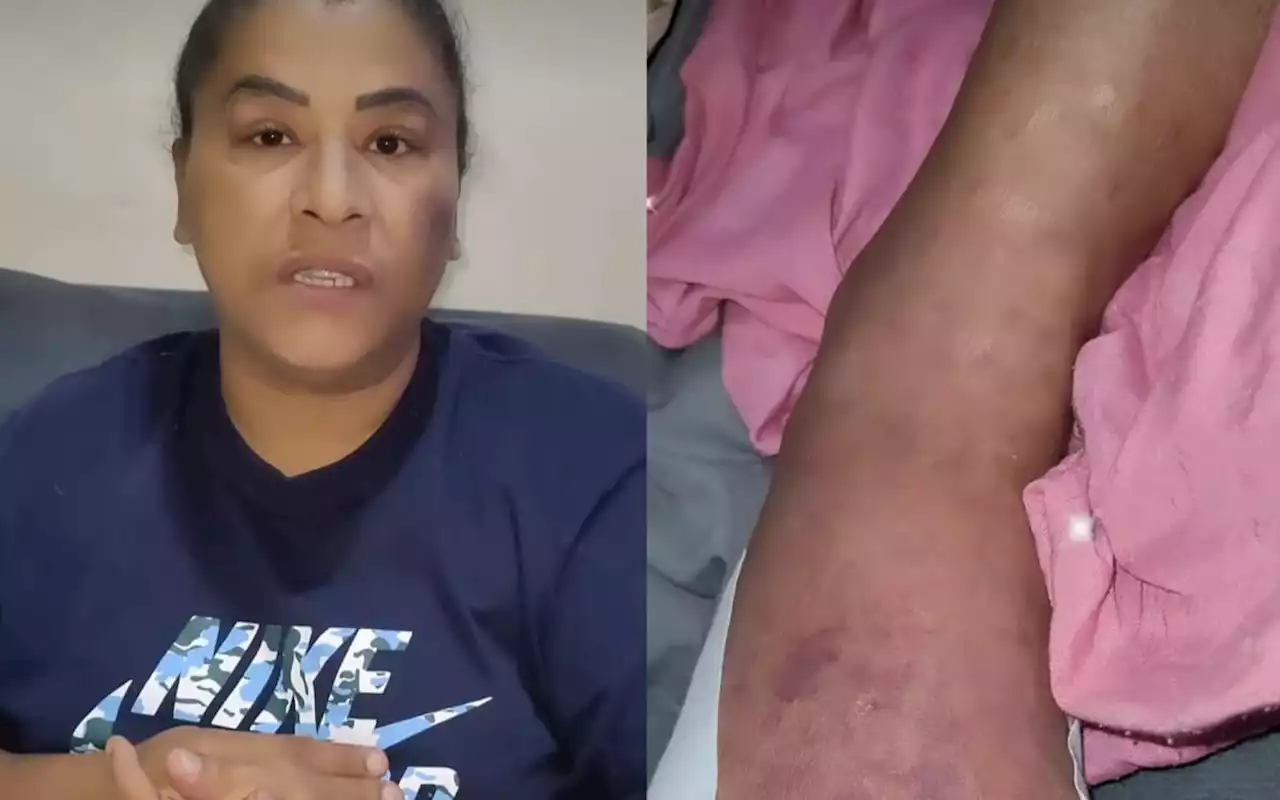 MC Katia revela tumor benigno e desabafa: 'Não estou conseguindo andar' | Celebridades | O Dia