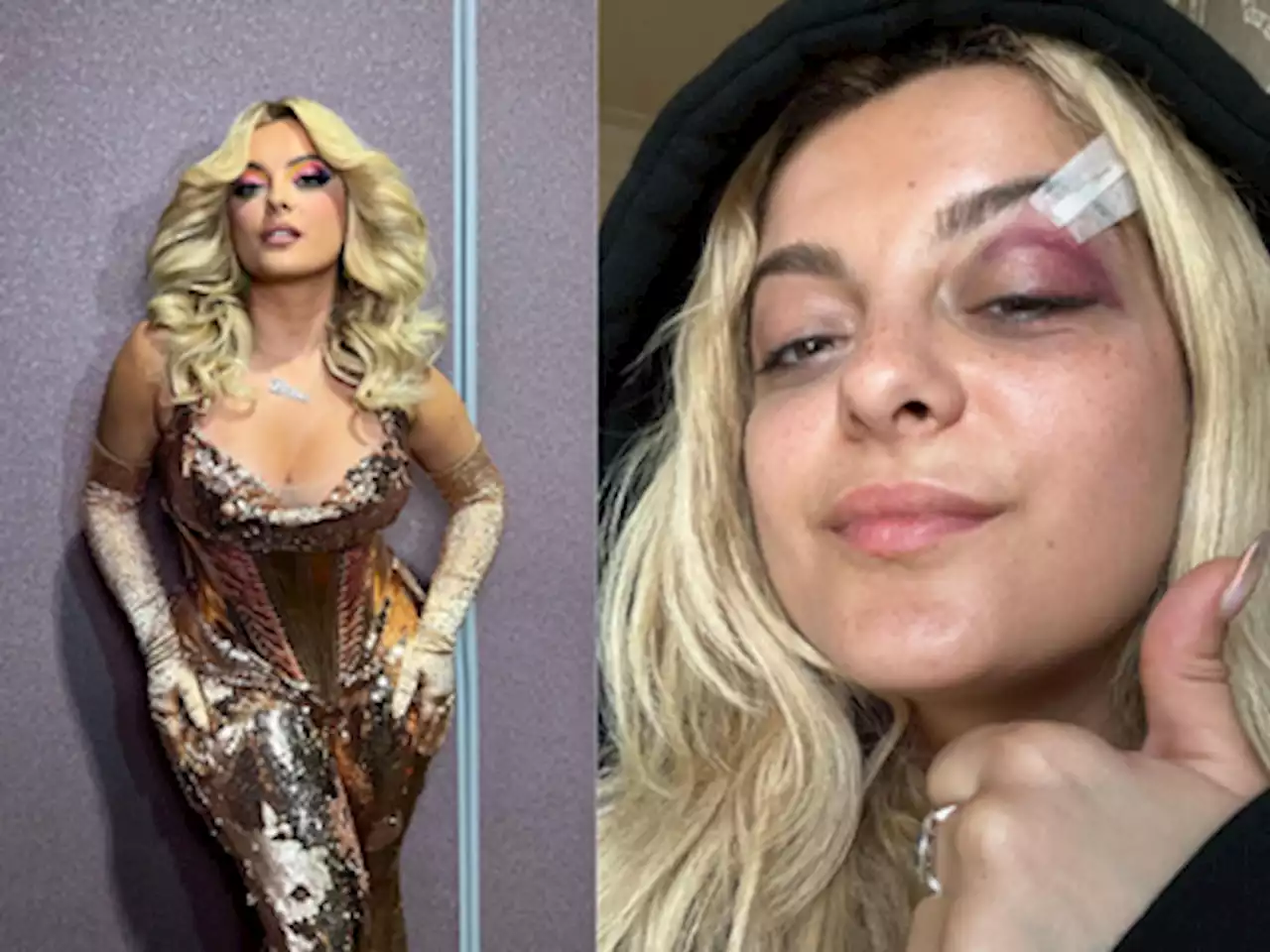 Bebe Rexha doing 'good' after fan throws phone on stage