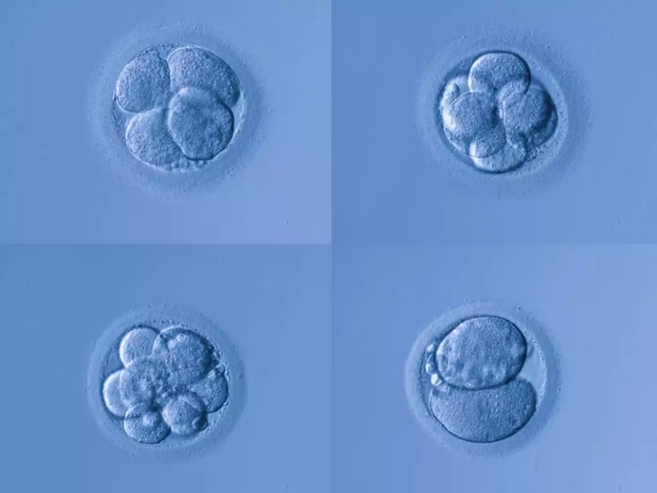 Model human embryo with beating heart developed without sperm or egg