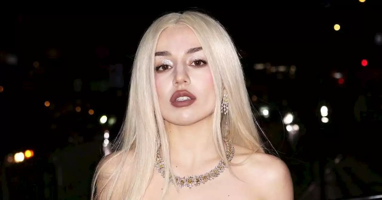 Ava Max 'Slapped So Hard' by Concertgoer She Sustained an Eye Injury