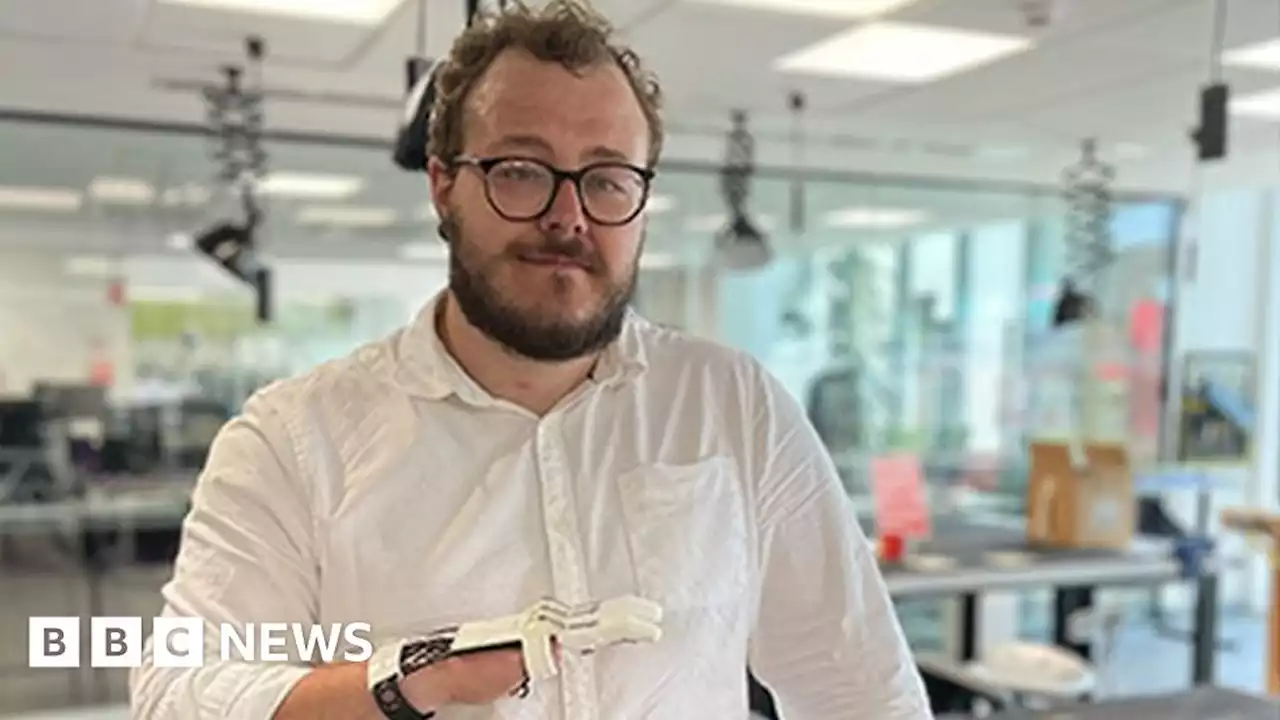 Staffordshire student with missing fingers designs prosthetic