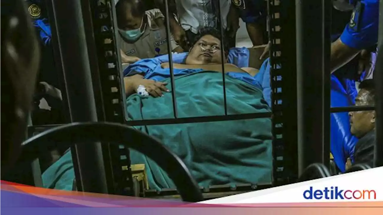 Pria Obesitas 300 Kg Meninggal di RSCM, Dokter Sebut Alami Syok Septik