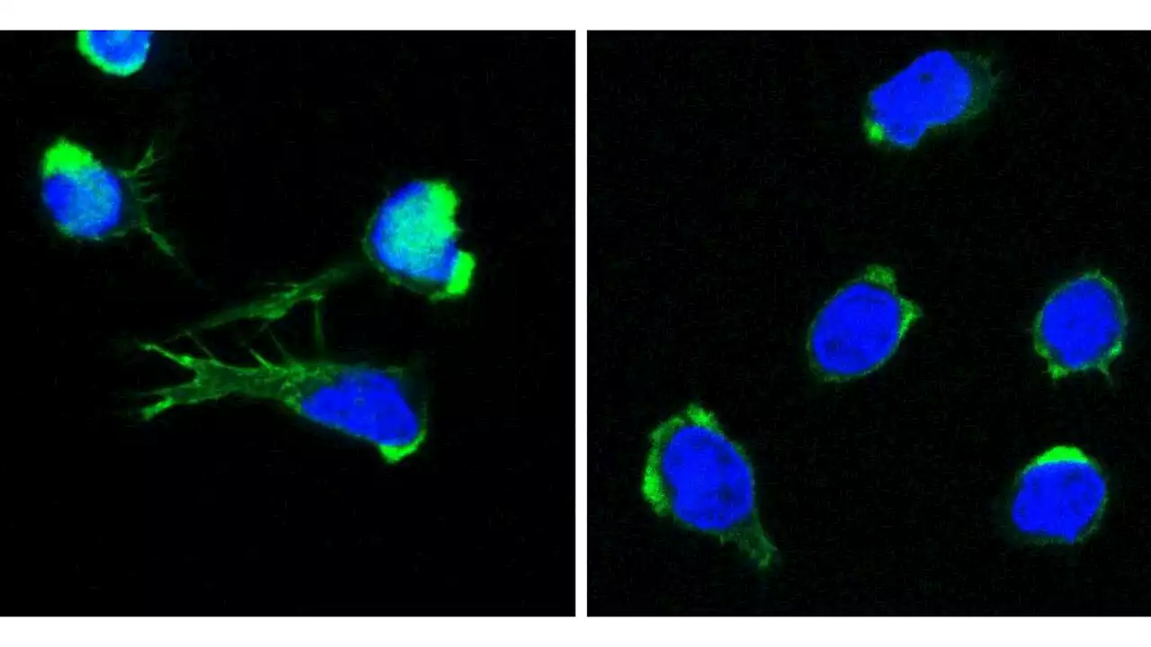 Newly discovered genetic defect disrupts blood formation and immune system