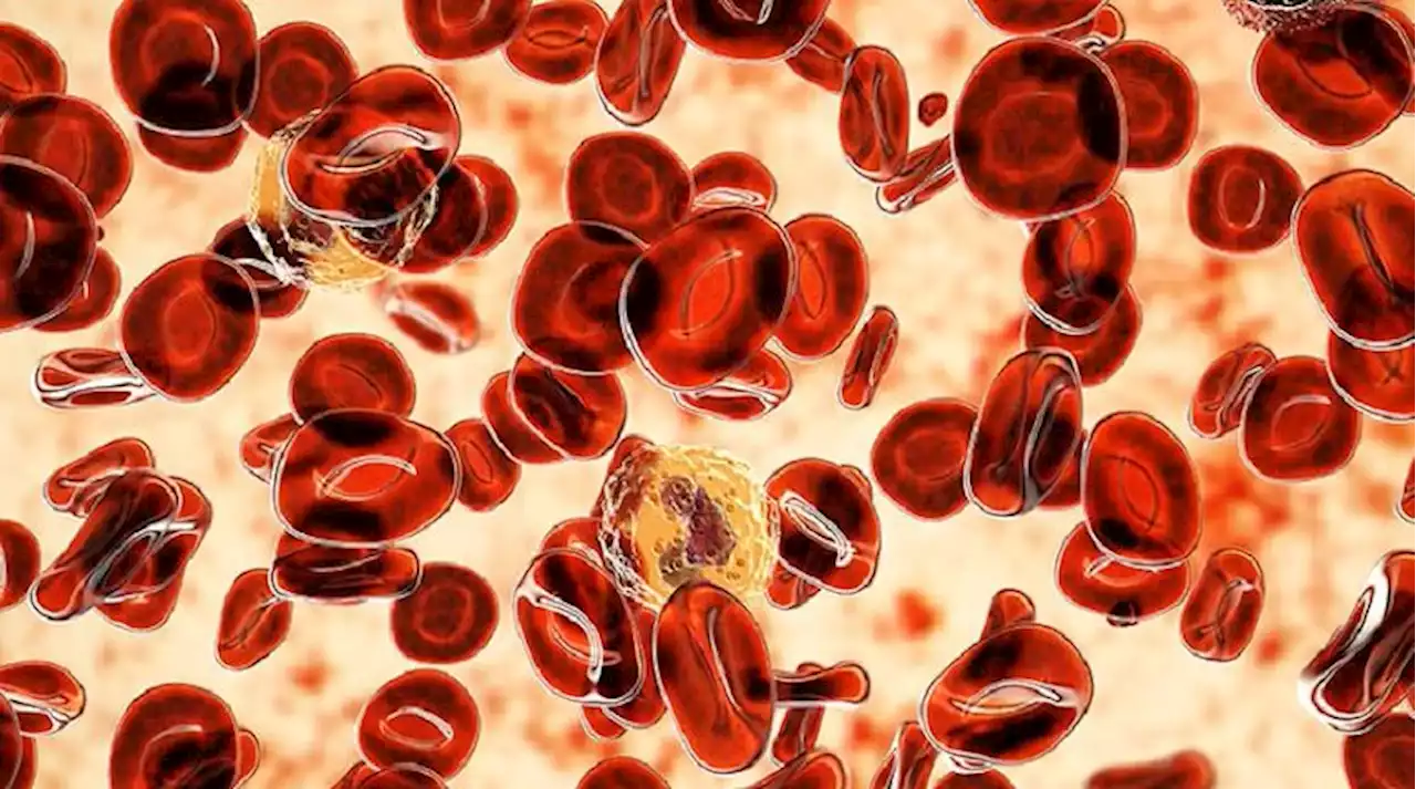 Novel Drug Shows 'Impressive' Efficacy in Polycythemia Vera