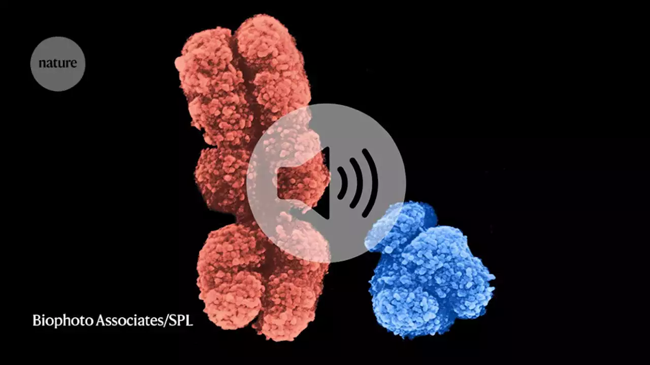 Why bladder cancer cells that shed their Y chromosome become more aggressive