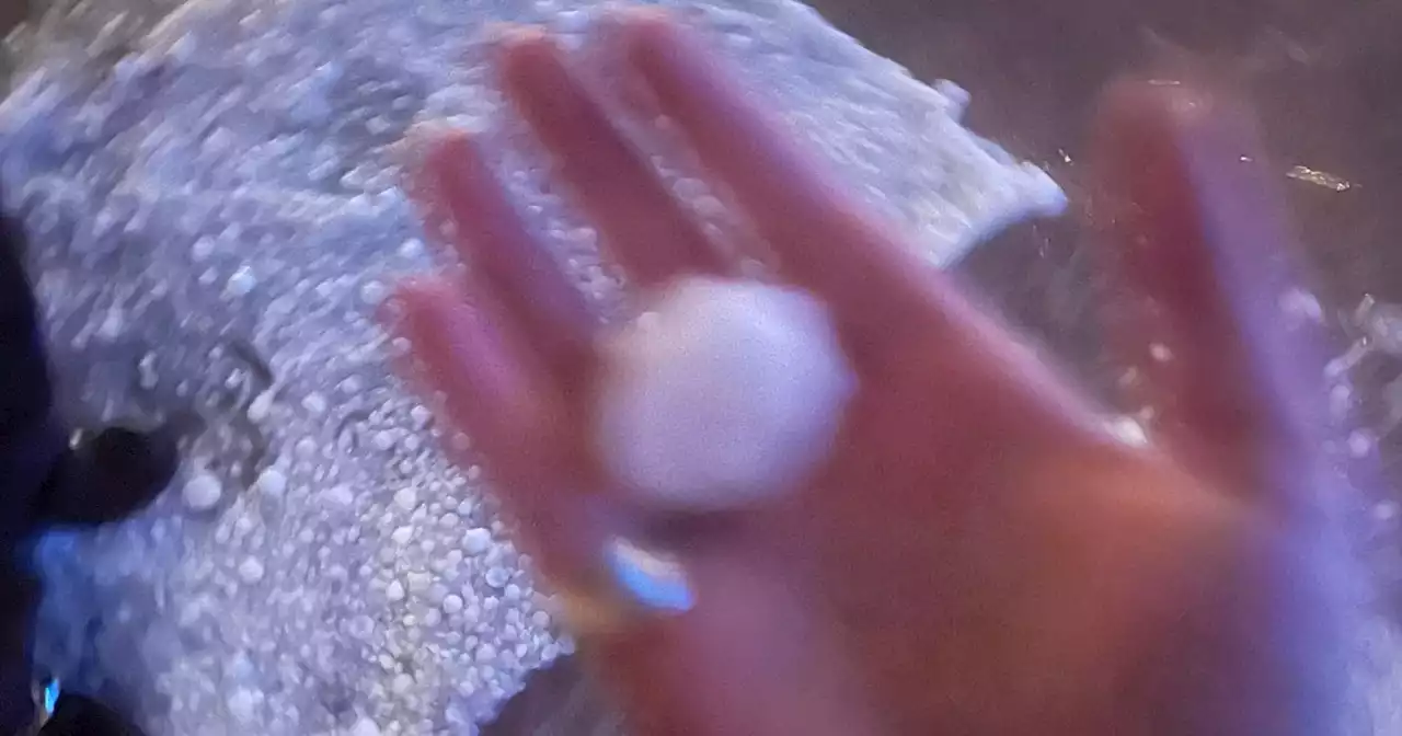 Massive hail storm pummels concertgoers, injuring nearly 100