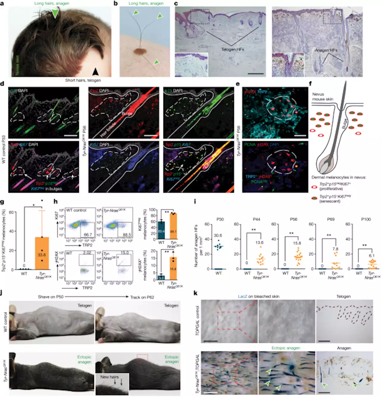 Signalling by senescent melanocytes hyperactivates hair growth - Nature