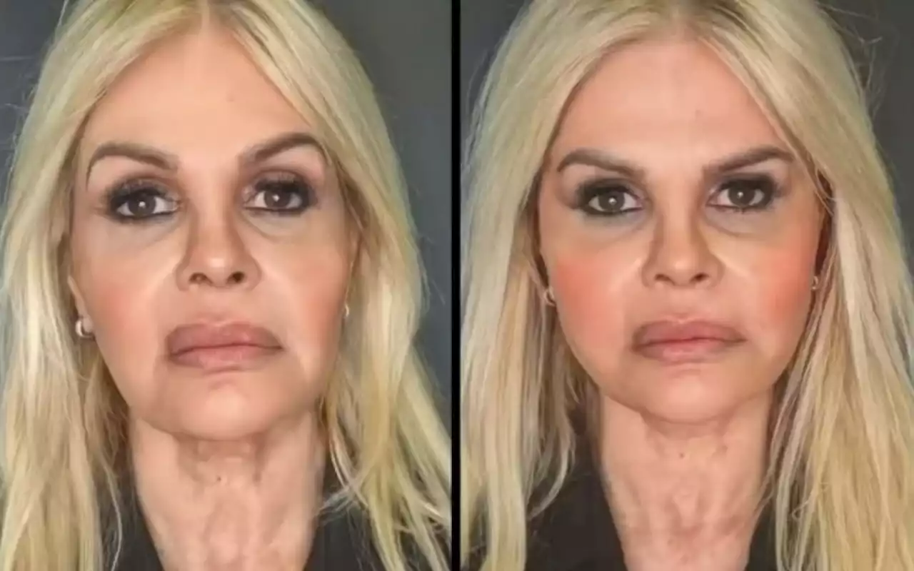 Monique Evans mostra resultado de harmonização facial; confira! | Celebridades | O Dia