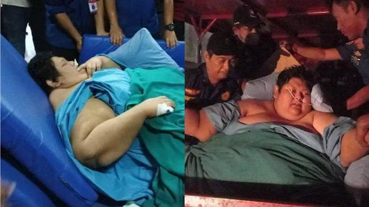 Inilah Penyebab Kondisi Fajri Pria Obesitas 300 Kg Terus Menurun hingga Meninggal Dunia - Tribunnews.com