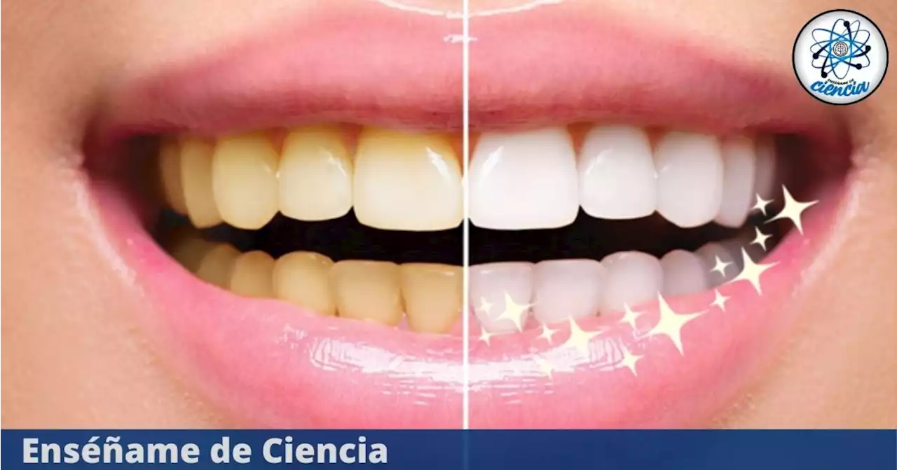 Blanquea y disminuye las manchas de tus dientes con estos ingredientes caseros