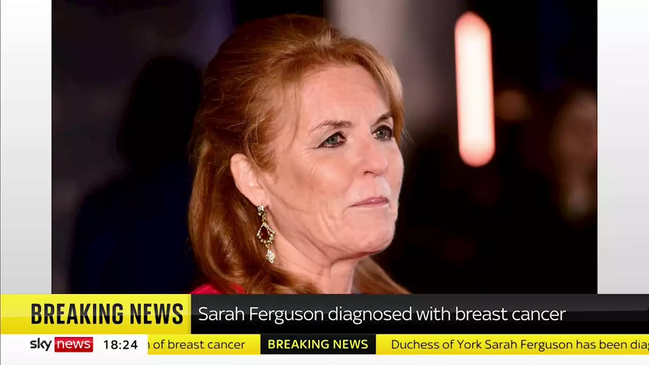 Sarah Ferguson, Duchess of York, treated for breast cancer