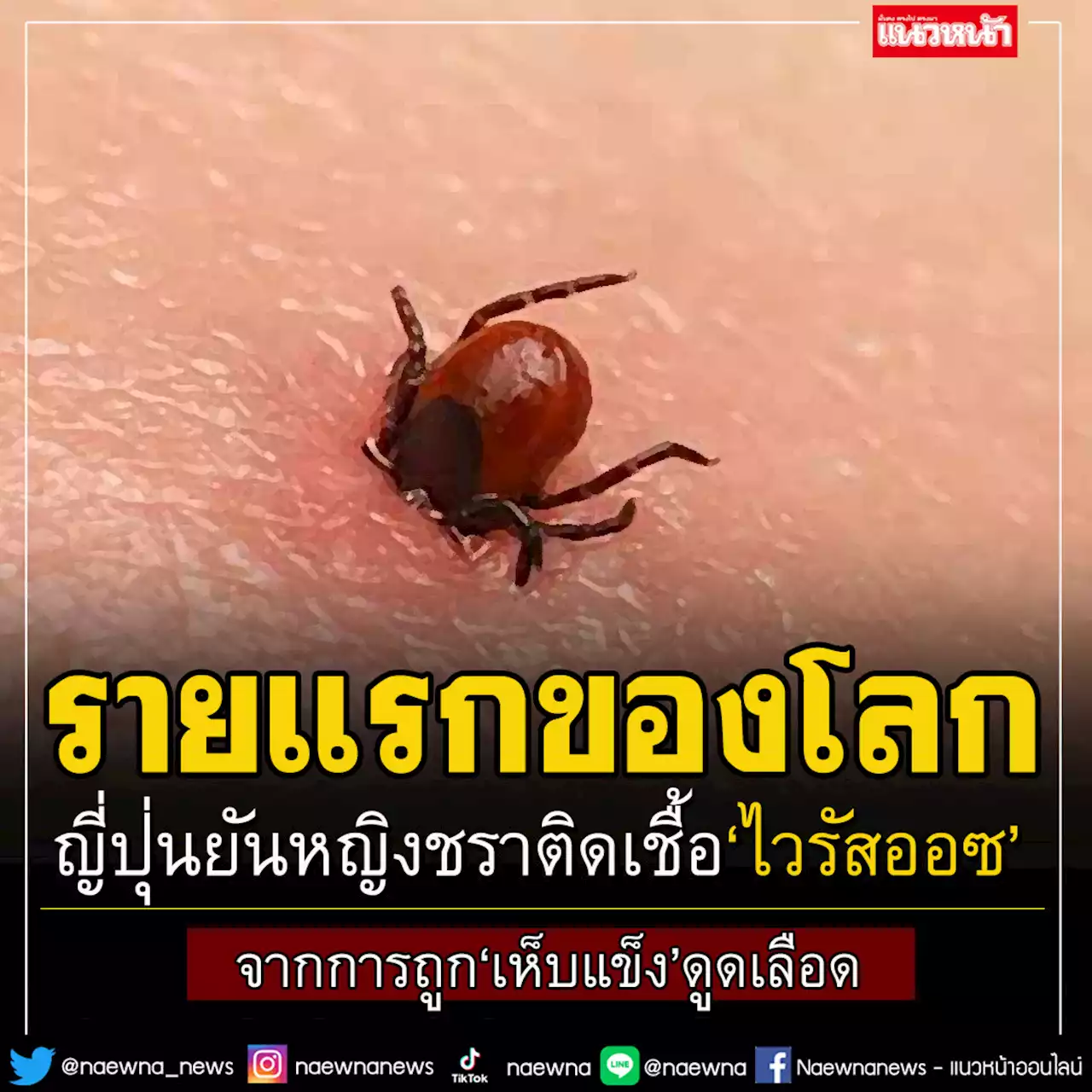 ดับรายแรกของโลก! ญี่ปุ่นยืนยันแล้วหญิงชราติดเชื้อ'ไวรัสออซ'จากการถูก'เห็บ'กัด