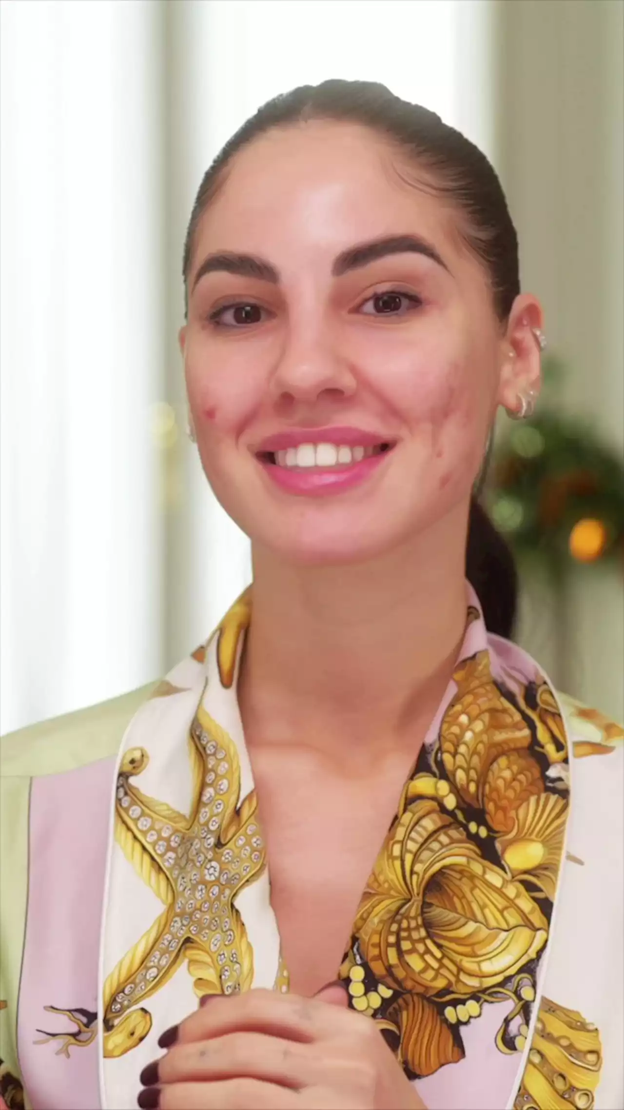 Giulia de Lellis, guida alla skincare e al trucco per pelle tendenza acneica