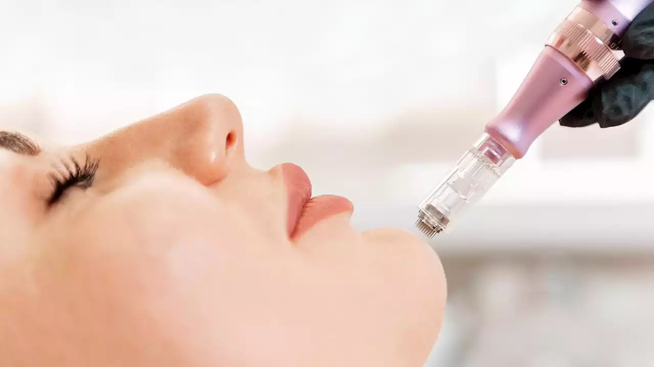 Microneedling-Pen: Welcher Dermapen ist tatsächlich effektiv?