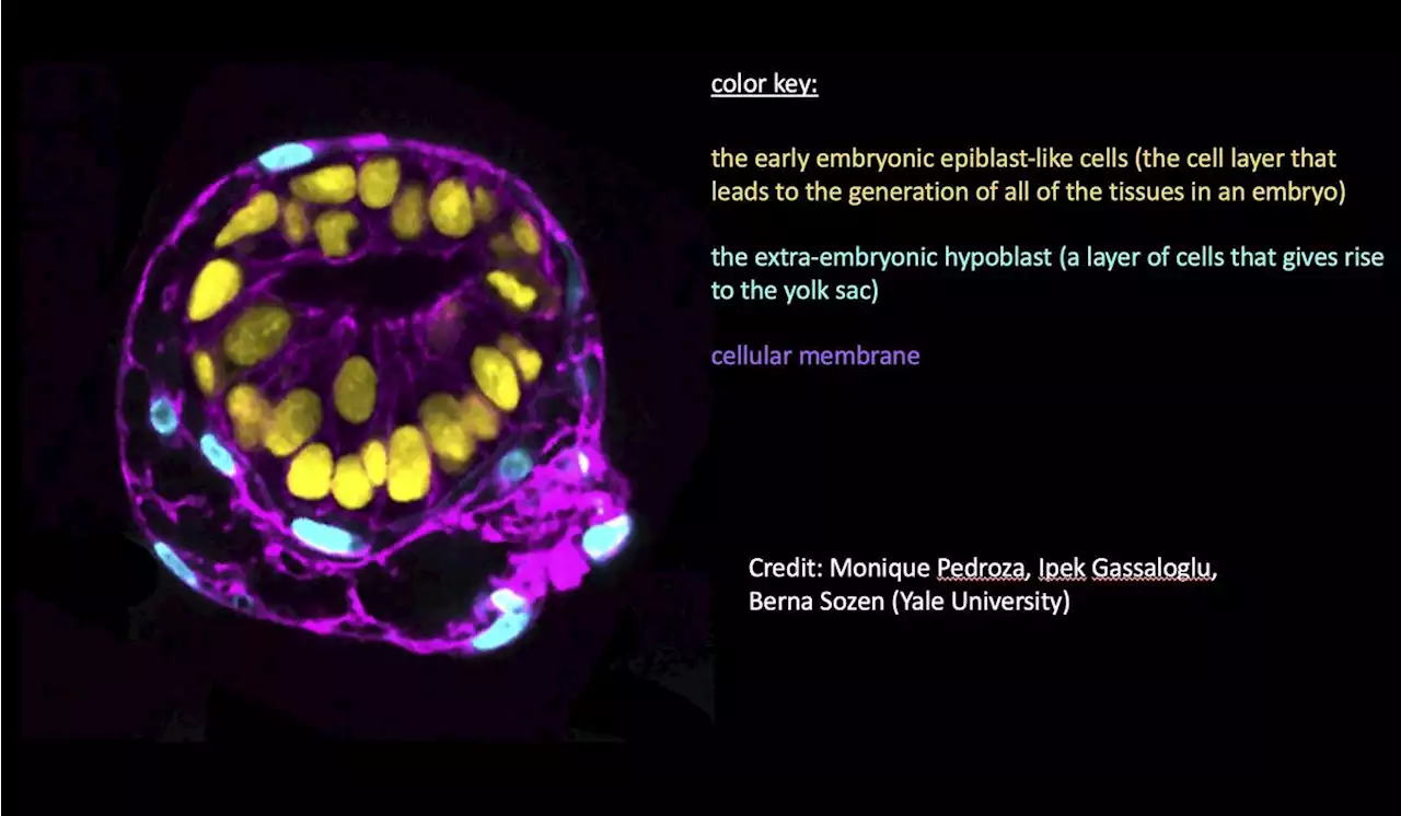 Scientists use stem cells to create models of human embryos and study our earliest days