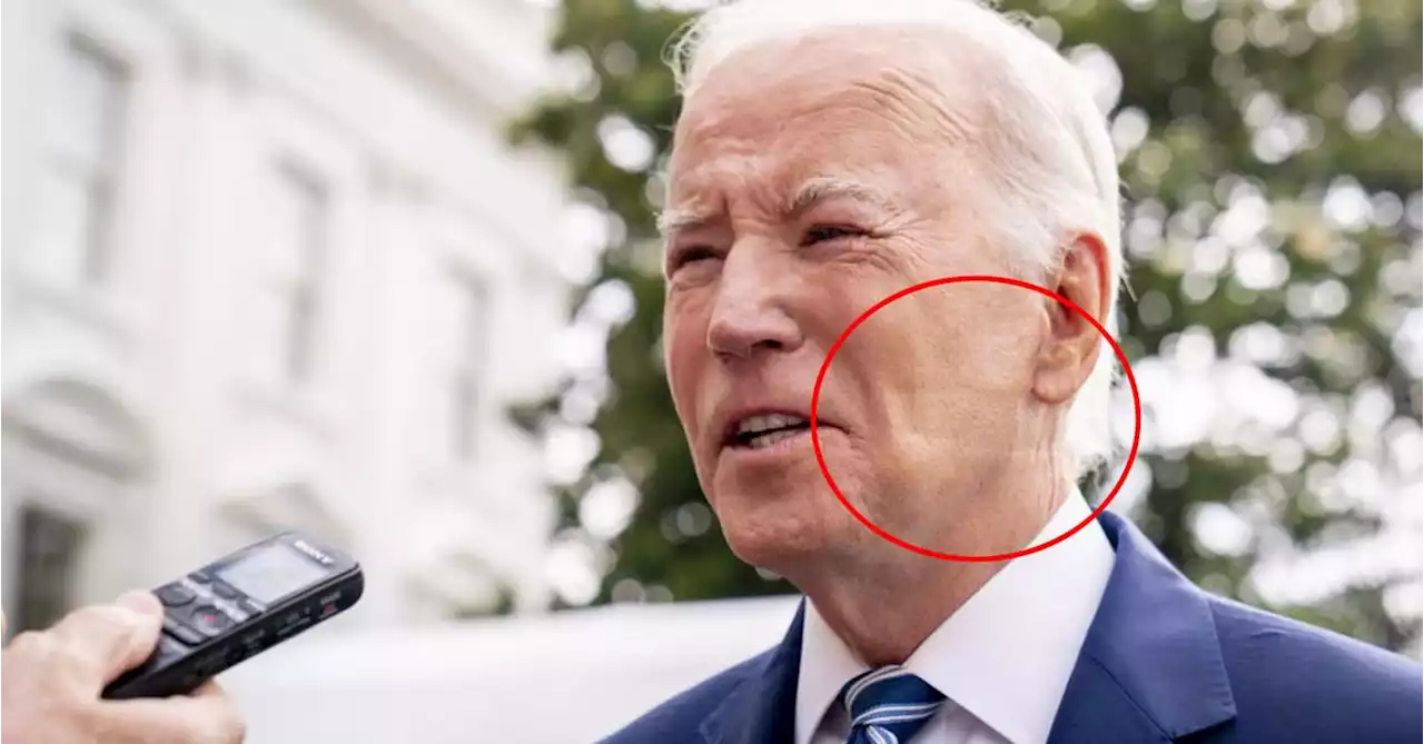 White House explains mark on Joe Biden's face