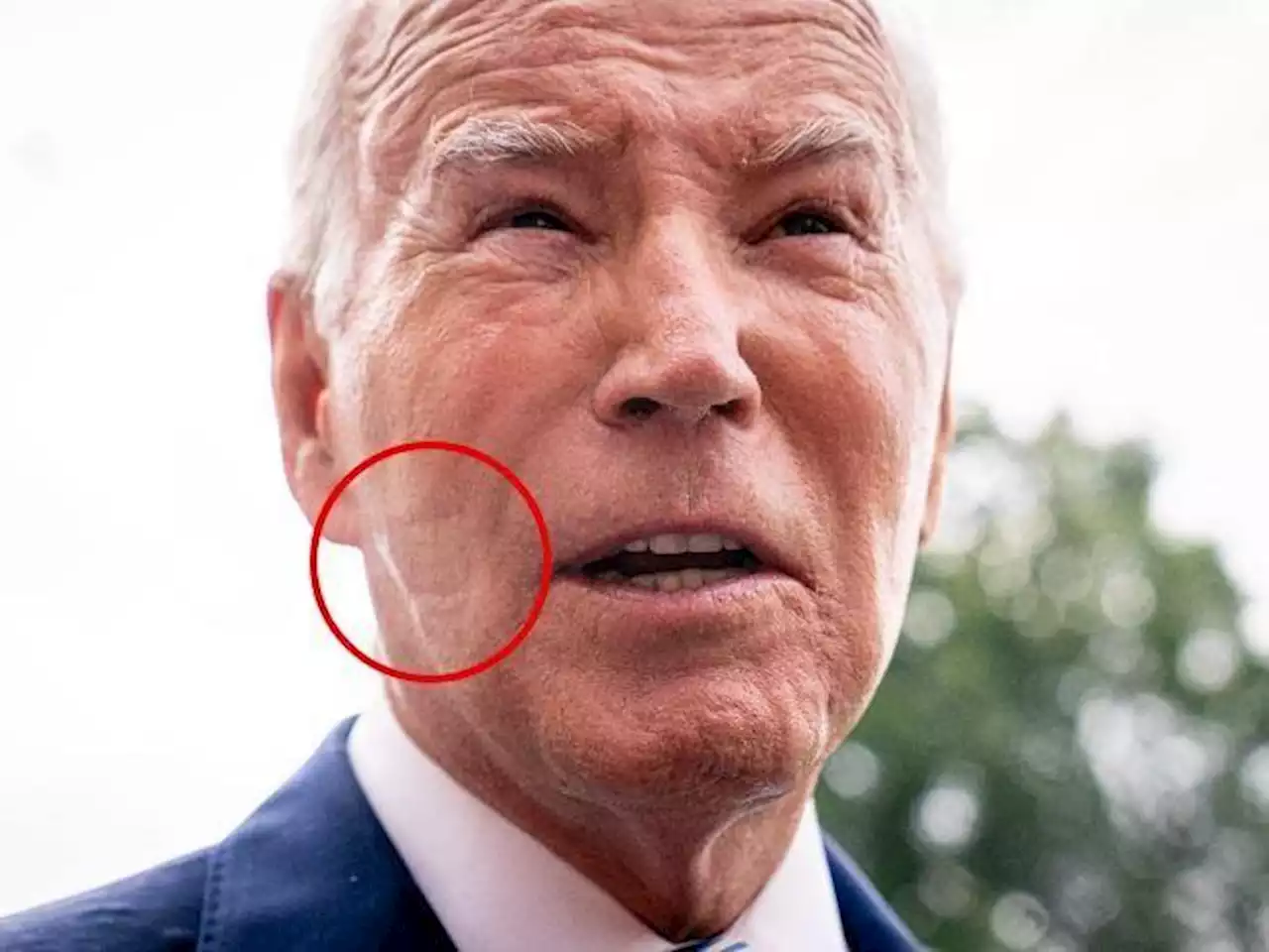 Joe Biden e i segni sul volto: usa la macchina Cpap per curare le apnee notturne