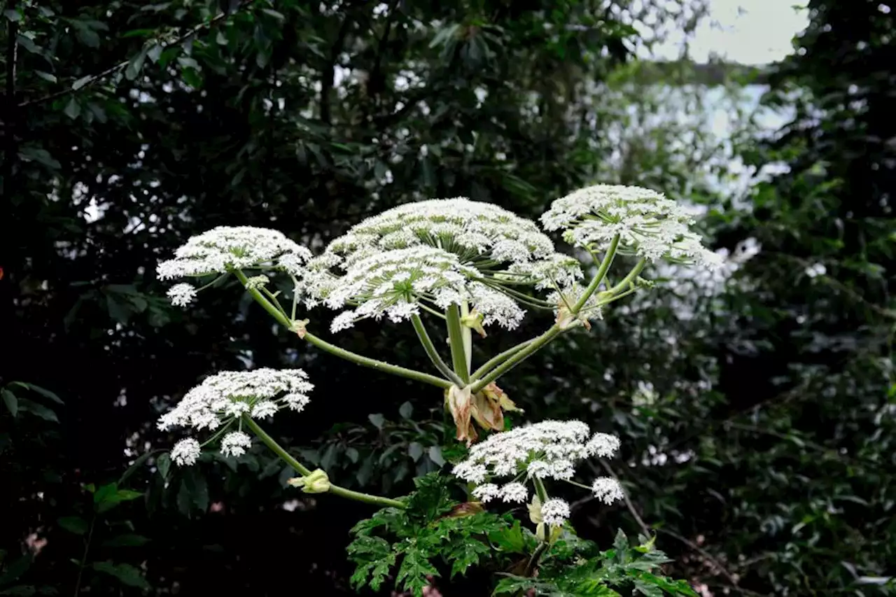 Warning as Giant Hogweed stings man in park leaving him with scarring