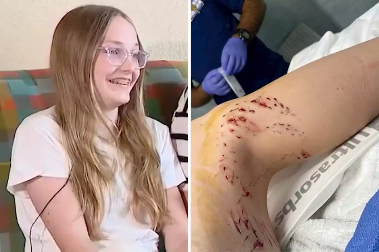 Girl attacked twice by shark: ‘I could see blood dripping down her leg’