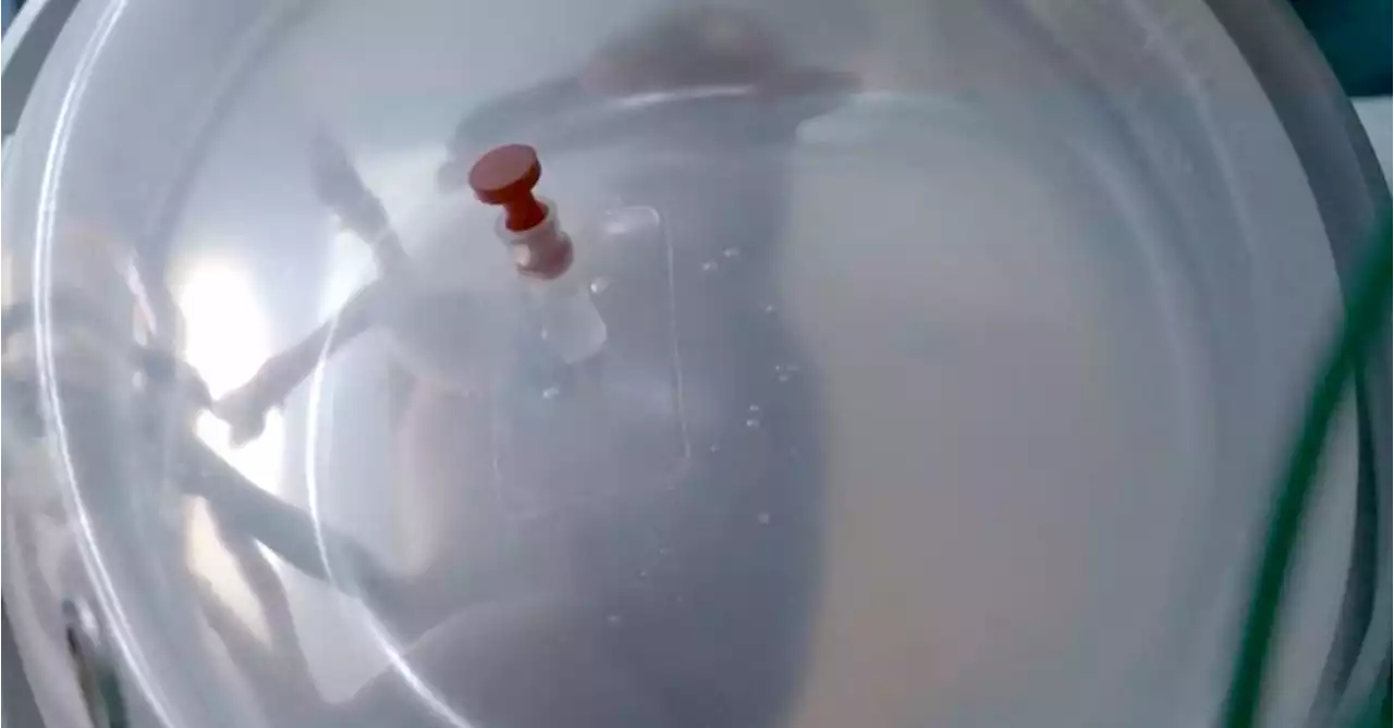 Spanish researchers aim to 'trick nature' with artificial womb