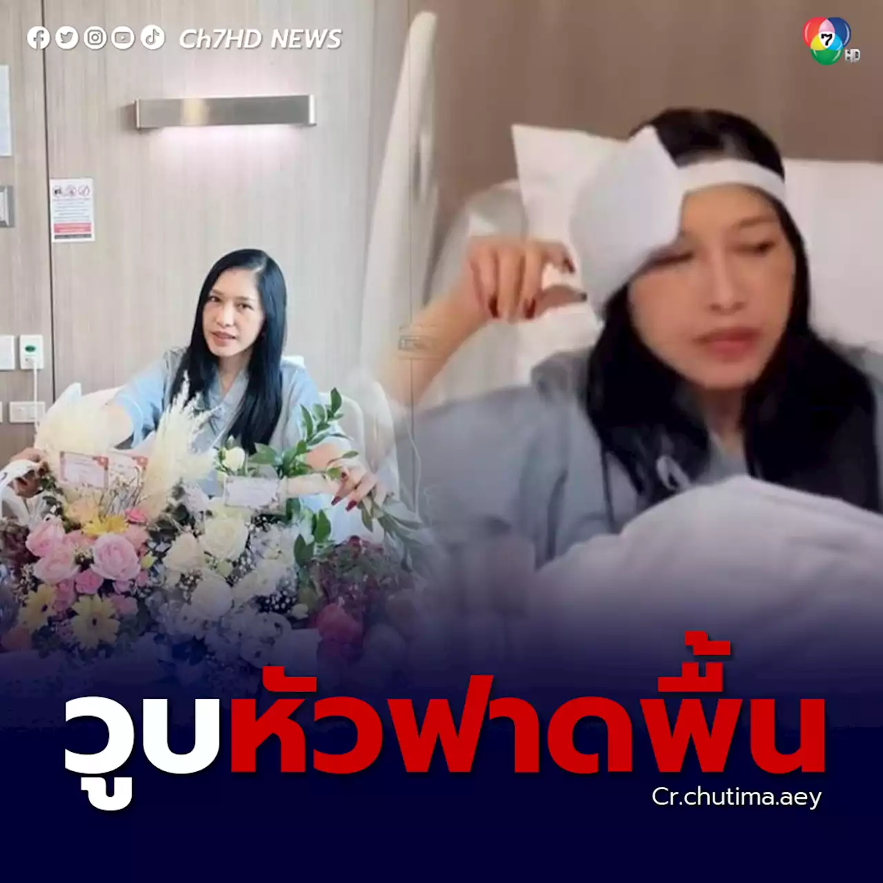 เอ้ ชุติมา ประสบอุบัติเหตุ วูบล้มศรีษะฟาดพื้นห้องน้ำ ถูกหามส่งโรงพยาบาลกลางดึก