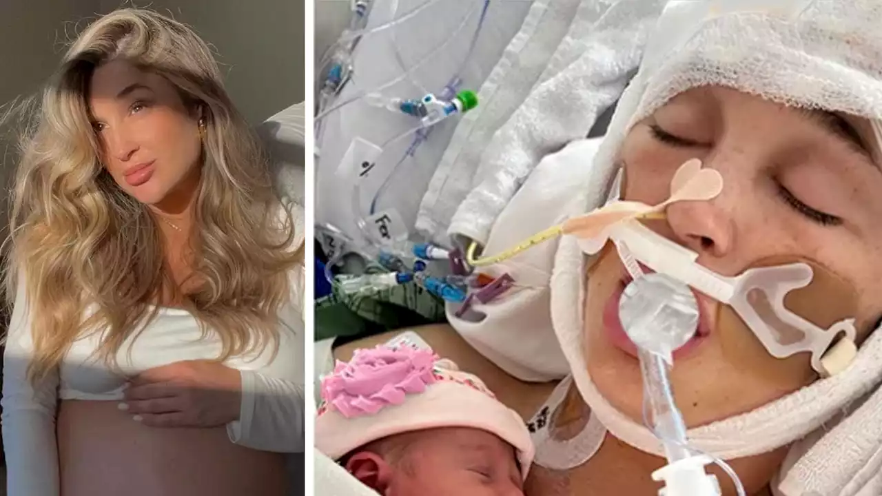 Pregnant Influencer In Medically Induced Coma After Aneurysm Week Before Due Date