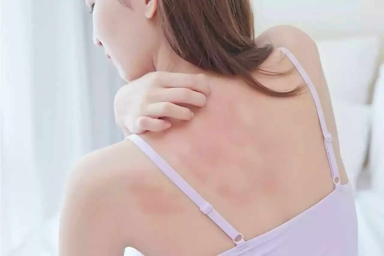 Red Itchy Skin Flare Ups How To Tell If You Have Eczema And When You Should See A Doctor 