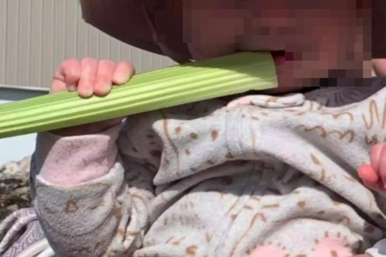 Urgent warning as baby left with 'margarita burn' after eating veggie sticks