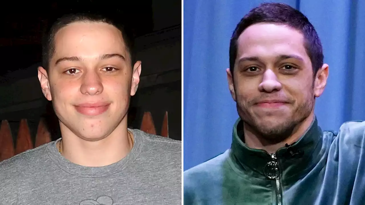 Pete Davidson -- Good Genes Or Good Docs?!