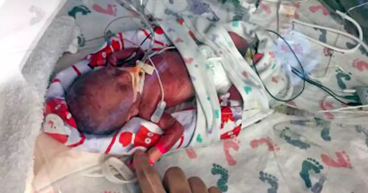 Colorado mother of micro-preemie baby to run 147 miles after son beats the odds