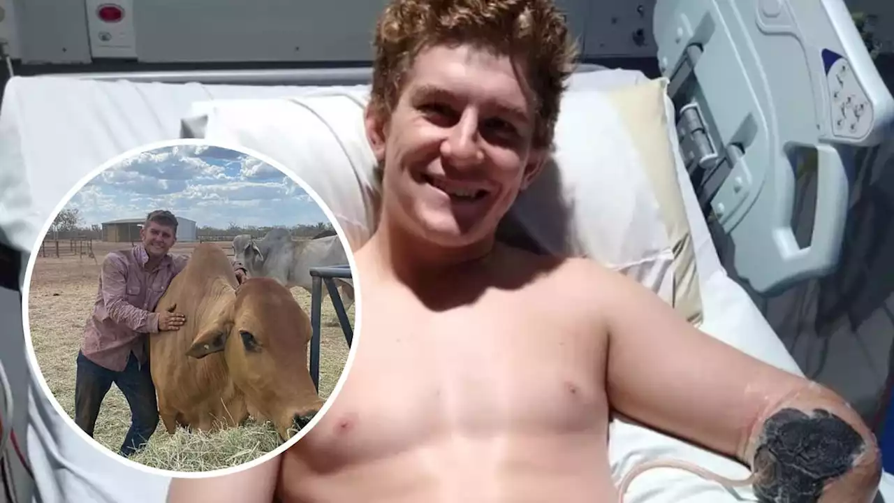 British backpacker, 23, loses arm in farm accident during gap year in Australia